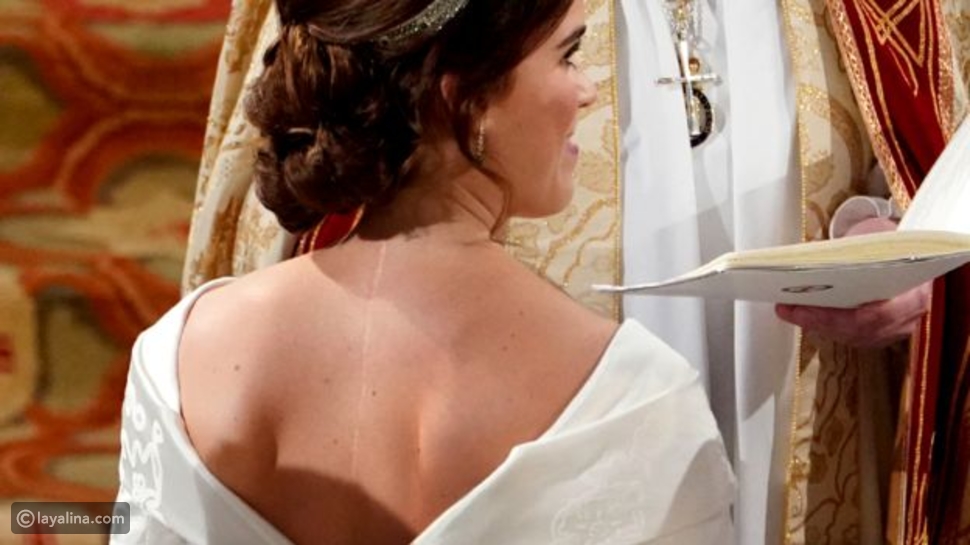 الأميرة أوجيني أصرت على عدم ارتداء طرحة لإظهار الندبة 