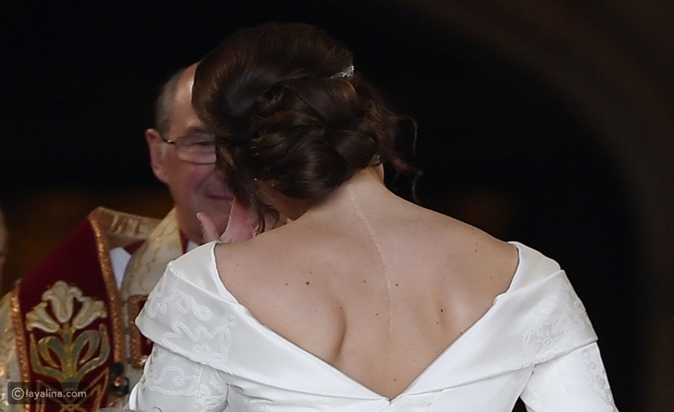 الأميرة اوجيني حفيدة الملكة إليزابيث ترسل رسالة مؤثرة من خلال ندبة ظهرها