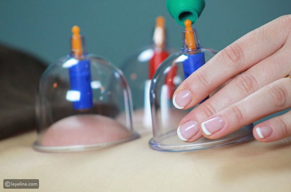 فوائد الحجامة للرجال والنساء ليالينا